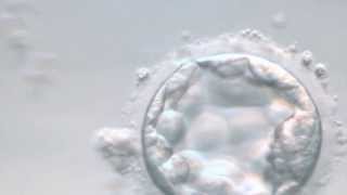 ES cell microinjection into a mouse blastocyst [upl. by Greeley]