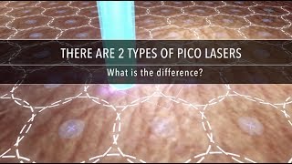 Why Are There Different Types of Pico Laser  Dr Kenneth Thean [upl. by Enaek]