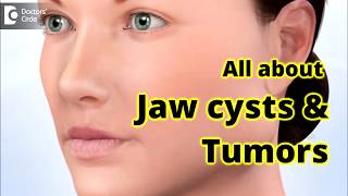 Jaw Cysts amp Tumors Diagnosis amp Treatment  Dr Girish Rao [upl. by Tamah]