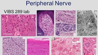 Peripheral Nerve Sliders amp Tensioners  Upper Limb Neurodynamics [upl. by Ailadi]