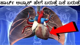 ಹೃದಯಾಘಾತದ ಲಕ್ಷಣಗಳು  Symptoms of heart attack in kannada [upl. by Carmelia434]