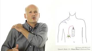 Chest Pain 3 Referred pain [upl. by Femmine]