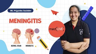 Meningitis and its Types  Medlive  Dr Priyanka Sachdev [upl. by Roarke]