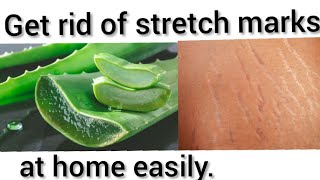 How to remove stretch Marks with Aloe vera at home [upl. by Ahtnahc]