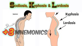 Lordosis Kyphosis and Scoliosis [upl. by Sibby670]