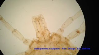 Amblyomma sculptum [upl. by Ashwin]