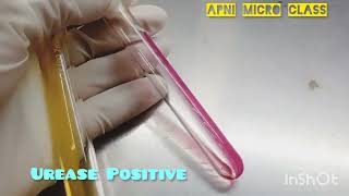 Urease test In Microbiology lab  How to read  Positive Urease reaction [upl. by Rehctaht]