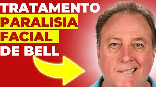 O MELHOR TRATAMENTO DA PARALISIA FACIAL DE BELL  Tratamento Atualizado para Recuperação Rápida [upl. by Annaujat]