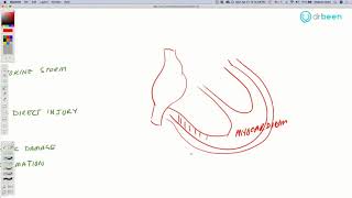 COVID19 Insights Heart Patients [upl. by Alil]