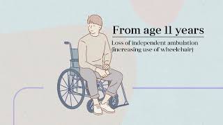 The Natural History of DMD Duchenne Muscular Dystrophy [upl. by Eellah]