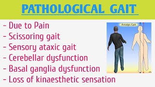 Pathological Gait [upl. by Alber]