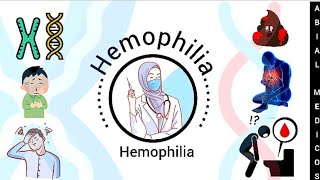 Hemophilia  Causes  Sign and symptoms  Diagnosis  Treatment  Hemophilia in urdu [upl. by Asha]