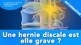 HERNIE DISCALE  Estelle grave [upl. by Grewitz]