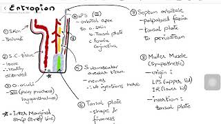 Entropion  with Lid Anatomy amp Surgical Management [upl. by Nacim]