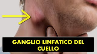 CRECIMIENTO DE GANGLIOS LINFÁTICOS EN LA REGIÓN DEL CUELLO ¿CAUSAS Y TRATAMIENTO [upl. by Nelleh383]