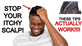 HOW TO STOP ITCHY SCALP FROM BRAIDSCORNROWS  𝙖𝙡𝙡 𝙩𝙝𝙚 𝙩𝙞𝙥𝙨 𝙮𝙤𝙪 𝙣𝙚𝙚𝙙 𝙩𝙤 𝙠𝙣𝙤𝙬 [upl. by Aicemed]