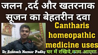 cantharis homeopathic medicine uses [upl. by Doherty593]