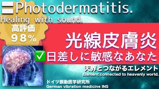 ✅光線皮膚炎 日差しに敏感なあなた〓Photodermatitis Relax amp Healing music with Dr Rife [upl. by Ayotal]