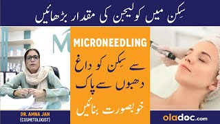 Benefits Of Micro Needling In Urdu  Chehre Ke Daag Dhabe Hatane Ke Liye  Collagen For Glowing Skin [upl. by Crescen]