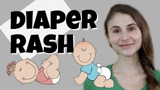 DIAPER RASH TIPS amp TRICKS FROM A DERMATOLOGIST DR DRAY [upl. by Bordy]