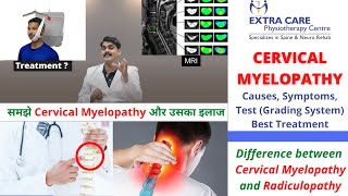 Cervical Myelopathy Physiotherapy Treatment  Causes Symptoms Test amp Grading  NO SURGERY NEEDED [upl. by Rahm430]