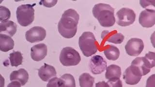 malaria plasmodium vivax in labratory [upl. by Sallie374]