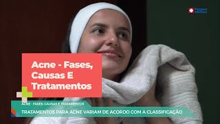 Acne fases causas e tratamentos [upl. by Tobit]