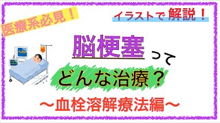 教科書をわかりやすく！「脳梗塞の治療とは？〜血栓溶解療法（rtpa療法）をイラストで解説〜」 [upl. by Torie]