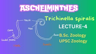 Aschelminthes  Trichinella spiralis Parasitic helminthes  Zoology  Notes in Description [upl. by Nylassej]