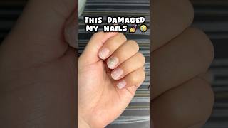 Nail extensions ki galti 😭😭nails nailsextension viralvideo shortsfeed viralshort trending [upl. by Neelrad]