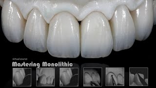 Mastering Monolithic Zirconia IN ENGLISH [upl. by Ahsilrak74]