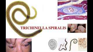 Triquinella spiralis [upl. by Naraa972]