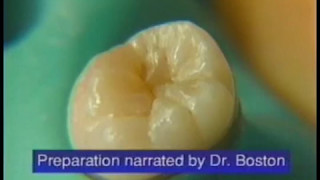 Fissurotomy®  How to Perform Minimally Invasive Fissure Exploration [upl. by Mcgannon68]