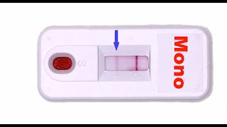 Rapid Mono Test How Does it Work [upl. by Oliviero]