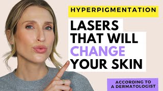 The Best Laser Treatments for Hyperpigmentation  Dr Sam Ellis [upl. by Eneli]