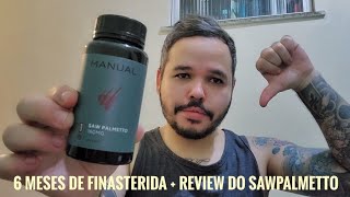 🔴 6 Meses de Finasterida Germed  Sawpalmetto Manual vale a pena [upl. by Hett]