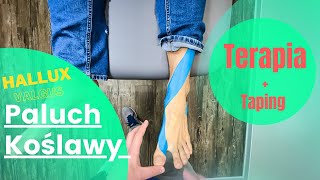 Paluch Koślawy Hallux Valgus  Terapia i taping 177 FizjoTerapia HD [upl. by Aicenat979]