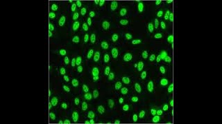 IIFANA STAINING PATTERNS INTERPRETATION  ANTINUCLEAR ANTIBODIES TESTING OF AUTOIMMUNE DISORDERS [upl. by Alba]