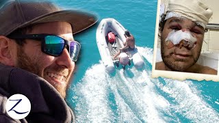 SAILOR SURVIVAL STORY Boating Accident Almost Cost Him His Life Ep 134 [upl. by Emawk77]