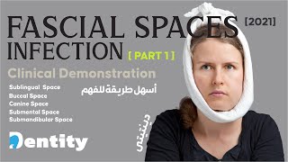 شرح مبسط  Fascial Spaces Infection  PART 12 [upl. by Nicoline]