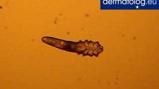 Nużeniec ludzki  Demodex folliculorum [upl. by Dewees]