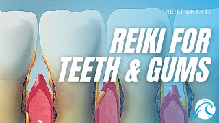 Reiki For Teeth And Gums [upl. by Emma]