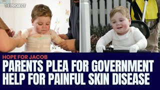 Parents Plea For Government Help For Painful Skin Disease [upl. by Geibel]