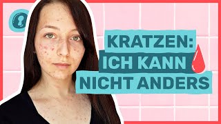 Skinpicking Krankhaft Pickel ausdrücken🩸😣  Auf Klo [upl. by Zysk]