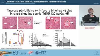 Acides biliaires homéostasie et réparation du foie  T TORDJMANN [upl. by Tterraj]