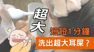 【診所洗耳患者】短短1分鐘竟然清洗出quot魔王級quot耳屎，驚訝到護士措手不及 [upl. by Klara]