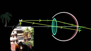 Human eye accommodation and near point Hindi  Human eye  Physics  Khan Academy [upl. by Llirpa]