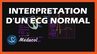 Electrocardiogramme ECG  interpretation dun ECG normal [upl. by Gemini]