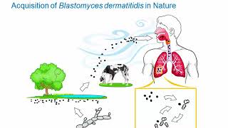 Dimorphic Fungi Blastomycosis Hot Topic [upl. by Ahsaeit]