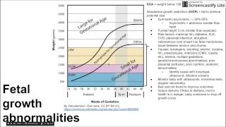 Fetal growth abnormalities [upl. by Rad]